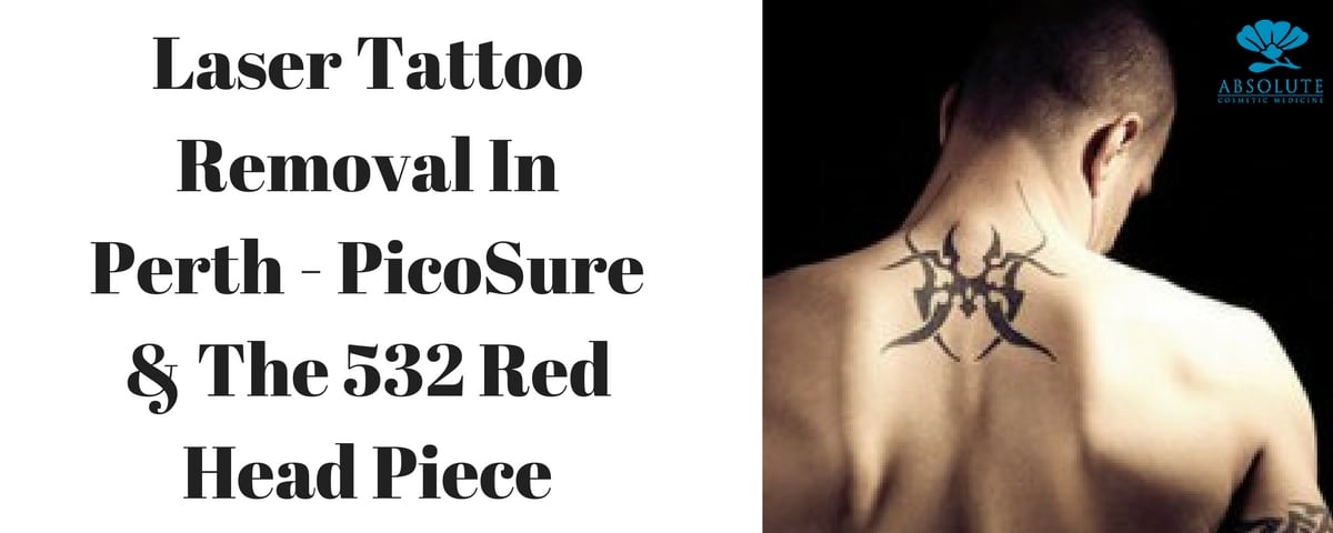 Laser Tattoo Removal In Perth Picosure The 532 Red Head Piece